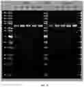 Fig. 22 - RAGE fusion proteins with improved stability and ligand binding affinity and uses thereof