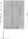 Fig. 13 - PATHOGEN BINDING PROTEINS