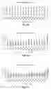 Fig. 11 - Antibodies to human complement C2B