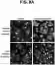 Fig. 11 - Anti-TREM2 antibodies and methods of use thereof