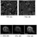 Fig. 04 - PLECTIN-1 BINDING ANTIBODIES AND USES THEREOF