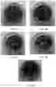 Fig. 05 - Nano-cellulose compositions, coatings, and uses thereof