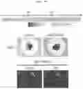 Fig. 11 - Production method for retinal tissue
