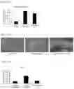 Fig. 09 - DIFFERENTIATION METHOD OF NEURAL STEM CELLS MANUFACTURED BY DIRECT CELL CONVERSION INTO ASTROCYTES