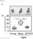 Fig. 08 - METHOD FOR REMOVING SENESCENT CELL, AND METHOD FOR PREPARING SENESCENT CELL