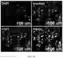Fig. 22 - FABRICATION TECHNIQUE FOR CARDIOMYOCYTE CLUSTER WITH IMPROVED VIABILITY IN CRYOPRESERVATION AND HYPOXIC CONDITION