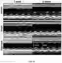 Fig. 34 - FABRICATION TECHNIQUE FOR CARDIOMYOCYTE CLUSTER WITH IMPROVED VIABILITY IN CRYOPRESERVATION AND HYPOXIC CONDITION