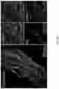 Fig. 50 - FABRICATION TECHNIQUE FOR CARDIOMYOCYTE CLUSTER WITH IMPROVED VIABILITY IN CRYOPRESERVATION AND HYPOXIC CONDITION