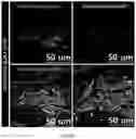 Fig. 54 - FABRICATION TECHNIQUE FOR CARDIOMYOCYTE CLUSTER WITH IMPROVED VIABILITY IN CRYOPRESERVATION AND HYPOXIC CONDITION