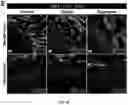 Fig. 57 - FABRICATION TECHNIQUE FOR CARDIOMYOCYTE CLUSTER WITH IMPROVED VIABILITY IN CRYOPRESERVATION AND HYPOXIC CONDITION