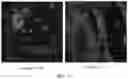 Fig. 37 - METHODS FOR THE MATURATION OF CARDIOMYOCYTES ON AMNIOTIC FLUID CELL-DERIVED ECM, CELLULAR CONSTRUCTS, AND USES FOR CARDIOTOXICITY AND PROARRHYTHMIC SCREENING OF DRUG COMPOUNDS