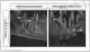 Fig. 01 - COMPOSITIONS AND METHODS FOR TREATMENT OF A MALABSORPTIVE DISORDER