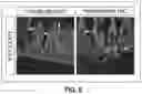 Fig. 17 - COMPOSITIONS AND METHODS FOR TREATMENT OF A MALABSORPTIVE DISORDER