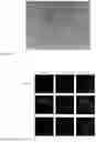 Fig. 03 - METHOD FOR IMPROVING ANGIOGENIC POTENTIAL OF A MESENCHYMAL STEM CELL