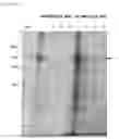 Fig. 05 - Enzymatic mutant suitable for homogeneous immunoassay method
