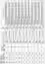 Fig. 15 - ALPHA-SYNUCLEIN ANTISENSE OLIGONUCLEOTIDES AND USES THEREOF