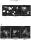 Fig. 10 - EXOSOMES AND MICRO-RIBONUCLEIC ACIDS FOR TISSUE REGENERATION