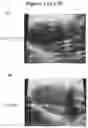 Fig. 22 - EXOSOMES AND MICRO-RIBONUCLEIC ACIDS FOR TISSUE REGENERATION