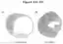 Fig. 23 - EXOSOMES AND MICRO-RIBONUCLEIC ACIDS FOR TISSUE REGENERATION