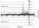 Fig. 11 - Polycomb-associated Non-Coding RNAs