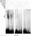 Fig. 21 - Polycomb-associated Non-Coding RNAs