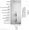 Fig. 12 - CLOSED-ENDED DNA (CEDNA) AND USE IN METHODS OF REDUCING GENE OR NUCLEIC ACID THERAPY RELATED IMMUNE RESPONSE