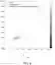 Fig. 16 - SYSTEMS AND METHODS FOR PERFORMING DIGITAL PCR