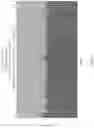 Fig. 03 - KARYOTYPING ASSAY