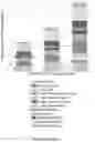Fig. 18 - DARC EXPRESSION AS PROGNOSTICATOR OF IMMUNOTHERAPY OUTCOMES