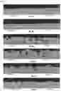 Fig. 05 - METHOD FOR MANUFACTURING A PART FROM ALUMINIUM ALLOY, THE ALLOY COMPRISING AT LEAST ZIRCONIUM AND MAGNESIUM