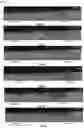 Fig. 08 - METHOD FOR MANUFACTURING A PART FROM ALUMINIUM ALLOY, THE ALLOY COMPRISING AT LEAST ZIRCONIUM AND MAGNESIUM