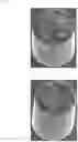 Fig. 04 - Composition for tin or tin alloy electroplating comprising suppressing agent