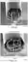 Fig. 11 - Electroplating Method for Enhancing the Performance of Rolled-Up Passive Components