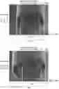 Fig. 12 - Electroplating Method for Enhancing the Performance of Rolled-Up Passive Components