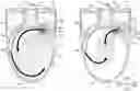 Fig. 01 - Toilet device