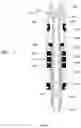 Fig. 07 - Downhole device for hydrocarbon producing wells without conventional tubing