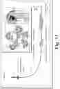 Fig. 18 - ADAPTIVE DRILLSTRING CONDITION DETERMINATION