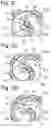 Fig. 04 - Scroll compressor and process for compressing a gaseous fluid with the scroll compressor