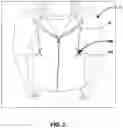 Fig. 03 - ATTACHMENT CLIPS FOR MOUNTING ON CORDS