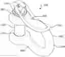 Fig. 01 - SHACKLE ASSEMBLY