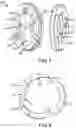 Fig. 04 - Rod packing