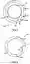 Fig. 06 - Rod packing