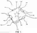 Fig. 02 - Stabilizing Support for an Item