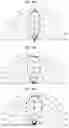 Fig. 10 - Light emitting apparatus and light radiator including the same
