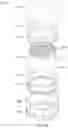Fig. 35 - Optical face protection apparatus and face protection apparatus