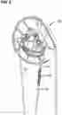 Fig. 06 - Archery bow with cable splitter