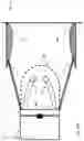 Fig. 25 - BALLISTIC DELIVERY METHOD AND SYSTEM FOR INJECTABLE FORMULATIONS