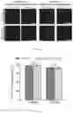 Fig. 11 - SYSTEM AND METHOD FOR QUANTIFYING MECHANICAL PROPERTIES OF A CELL