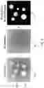 Fig. 08 - SYSTEMS AND METHODS FOR AUTOFOCUS AND AUTOMATED CELL COUNT USING ARTIFICIAL INTELLIGENCE