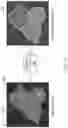 Fig. 11 - SYSTEMS AND METHODS FOR AUTOFOCUS AND AUTOMATED CELL COUNT USING ARTIFICIAL INTELLIGENCE